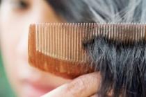 ریزش روزانه بیش از 100 تا 150 تار مو غیرطبیعی است