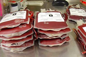 تزریق خون بی‌کیفیت در رگ‌های بیماران، نتیجه فقر مالی سازمان انتقال خون